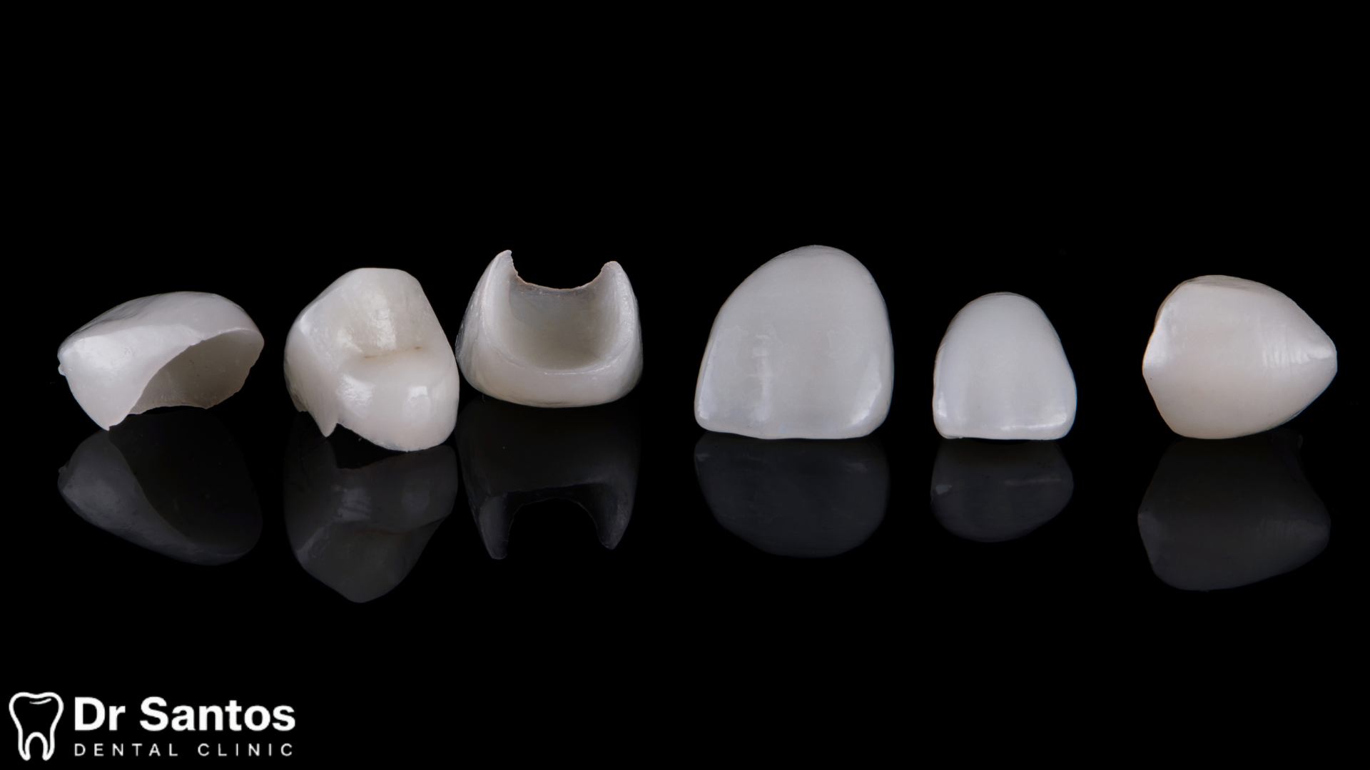 Diagrama mostrando la delgadez de una carilla de porcelana y su ajuste perfecto
